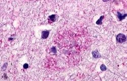 GPR119 Antibody, Novus Biologicals 50 &mu;g | Buy Online | Novus Biologicals | Fisher Scientific